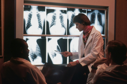 Una científica muestra una serie de radiografías del torso de una persona.