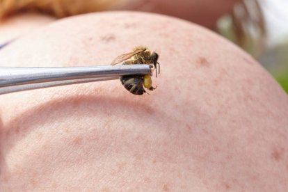 La medicina con abejas, conocida como apiterapia, es una terapia alternativa que utiliza productos de las abejas, como la miel, la jalea real y la apitoxina (veneno de abejas), para prevenir y tratar diversas enfermedades.