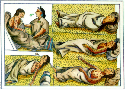 La viruela, transmitida por los españoles, fue una de las enfermedades a las que tuvieron que hacer frente.