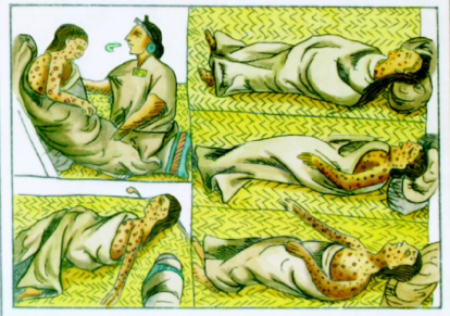 La viruela diezmó a la población indígena tras la llegada de los españoles; los nativos no tenían anticuerpos para esta nueva enfermedad que azotó la capital mexica en 1520.